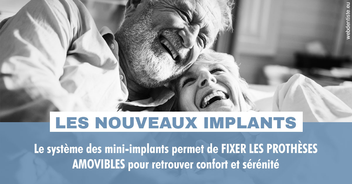 https://dr-knafou-abensur-anita.chirurgiens-dentistes.fr/Les nouveaux implants 2