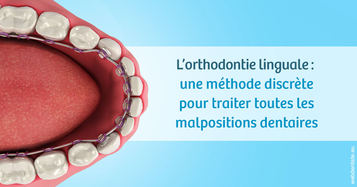 https://dr-knafou-abensur-anita.chirurgiens-dentistes.fr/L'orthodontie linguale 1