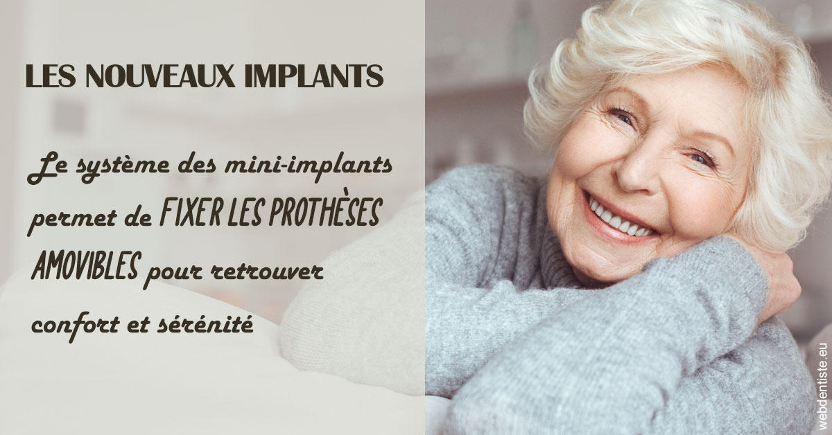 https://dr-knafou-abensur-anita.chirurgiens-dentistes.fr/Les nouveaux implants 1