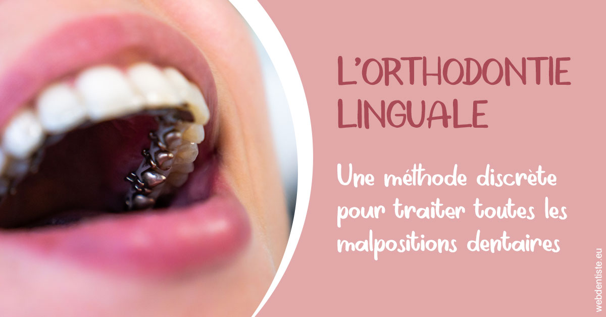 https://dr-knafou-abensur-anita.chirurgiens-dentistes.fr/L'orthodontie linguale 2