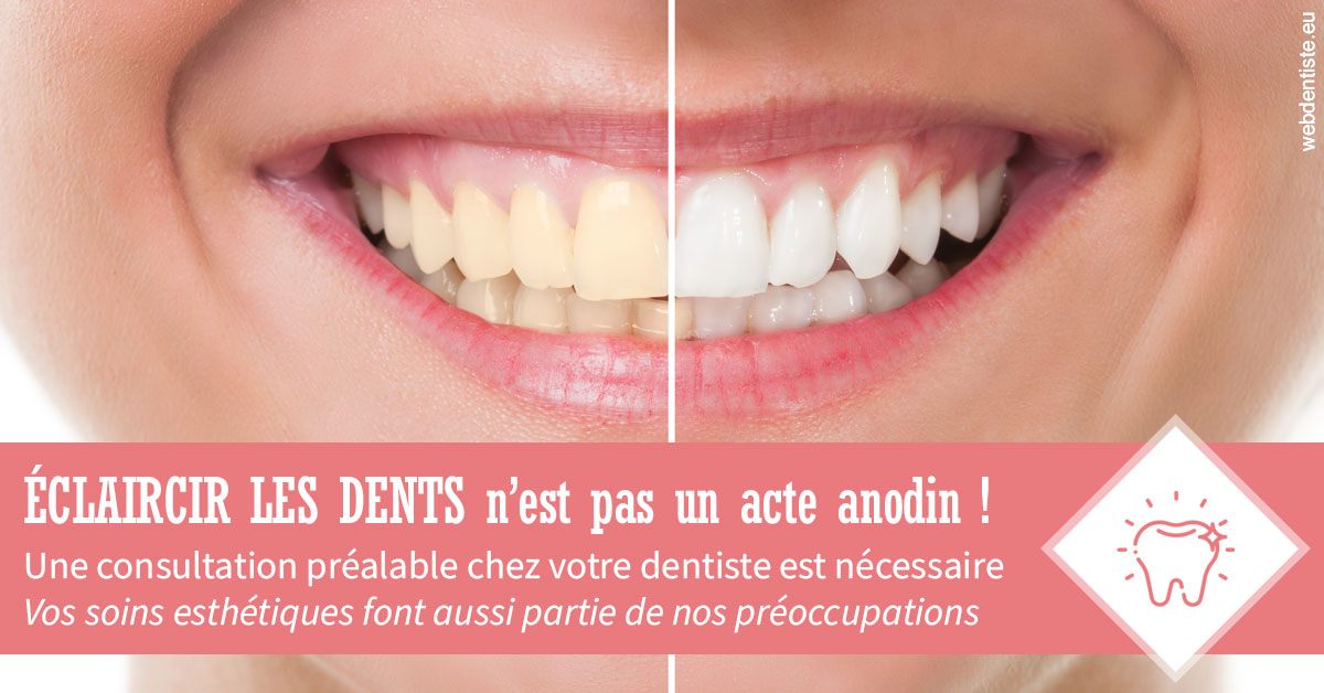 https://dr-knafou-abensur-anita.chirurgiens-dentistes.fr/Eclaircir les dents 1