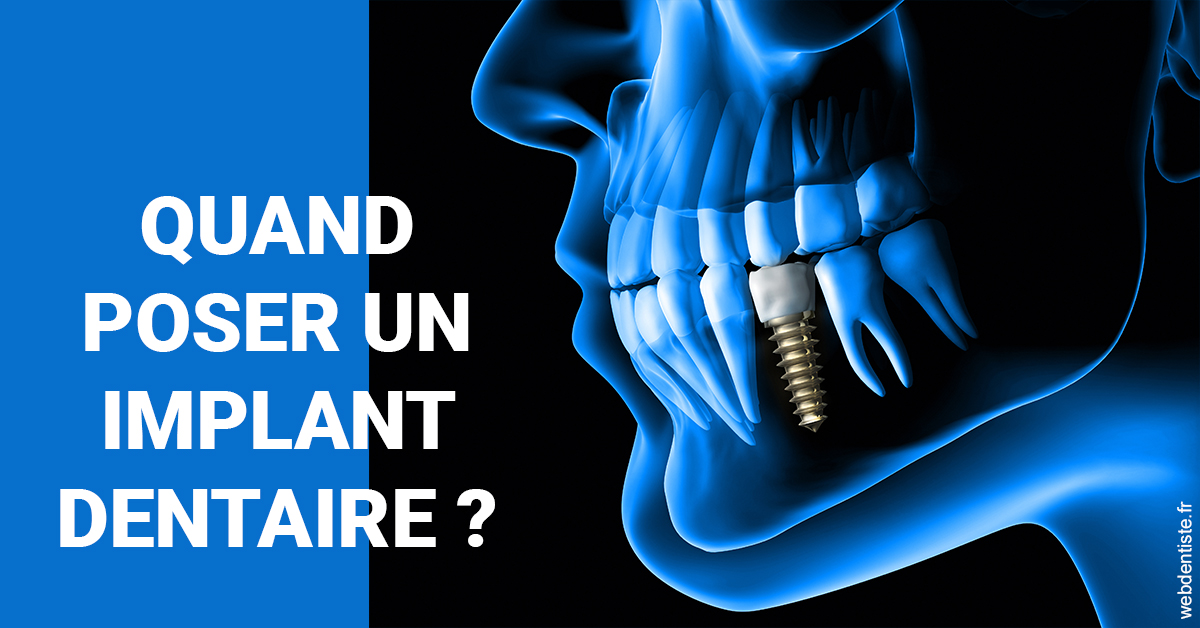 https://dr-knafou-abensur-anita.chirurgiens-dentistes.fr/Les implants 1