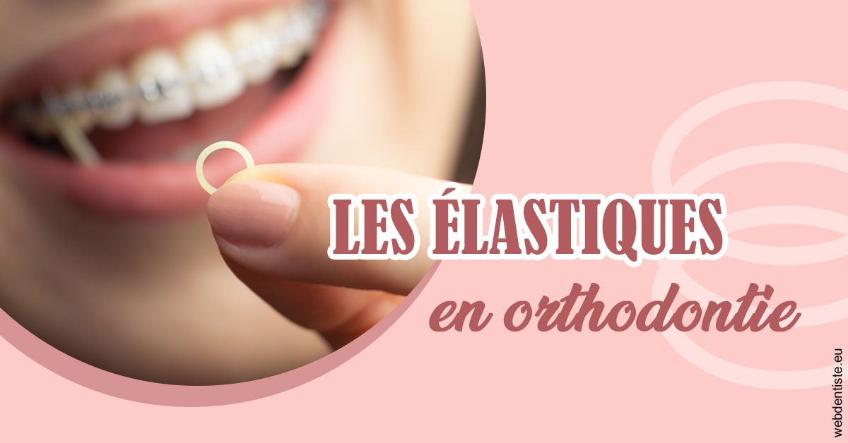https://dr-knafou-abensur-anita.chirurgiens-dentistes.fr/Elastiques orthodontie 1