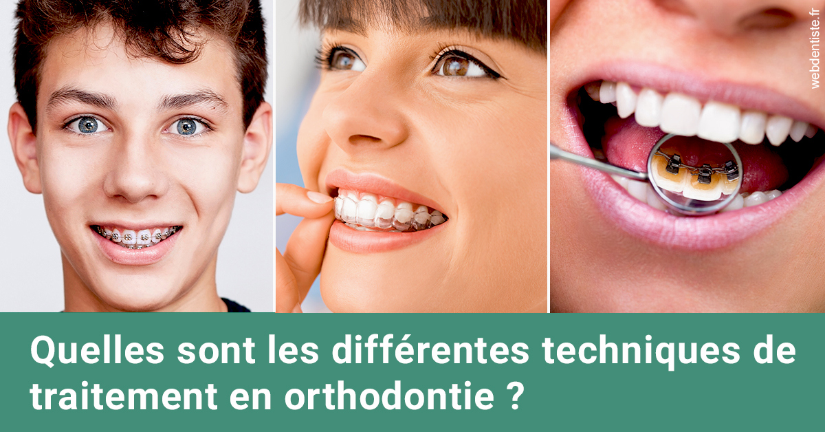 https://dr-knafou-abensur-anita.chirurgiens-dentistes.fr/Les différentes techniques de traitement 2