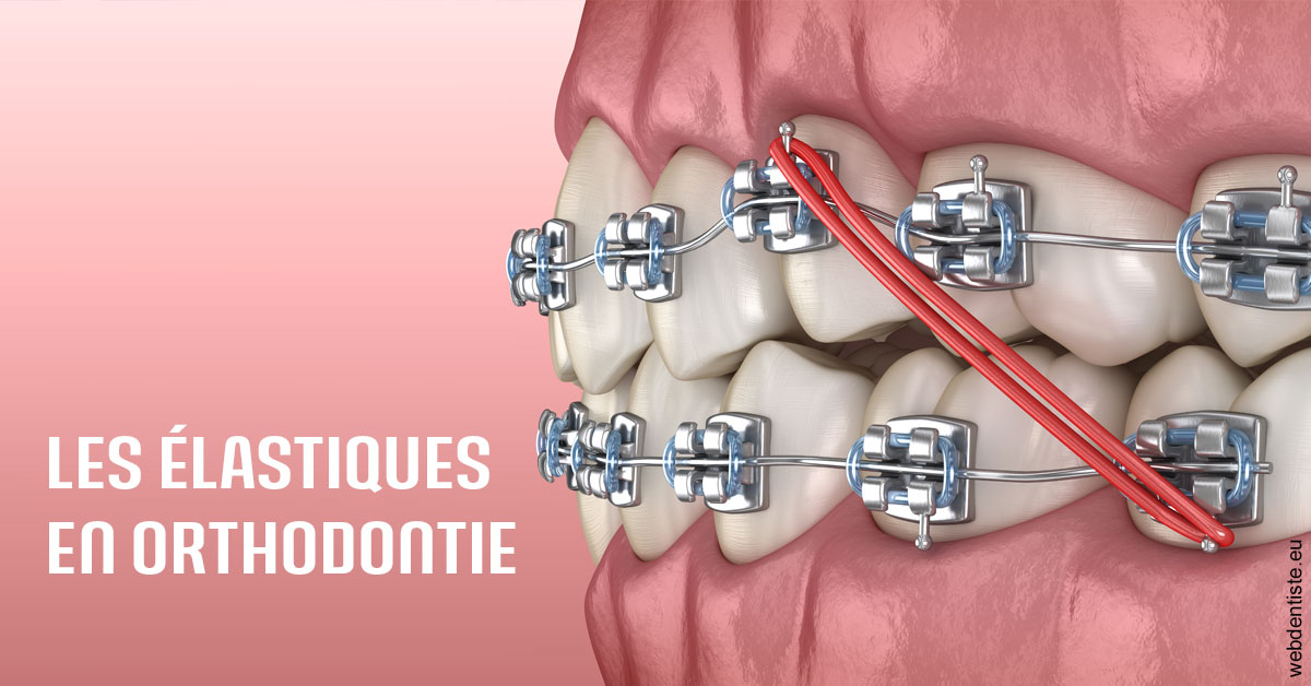 https://dr-knafou-abensur-anita.chirurgiens-dentistes.fr/Elastiques orthodontie 2