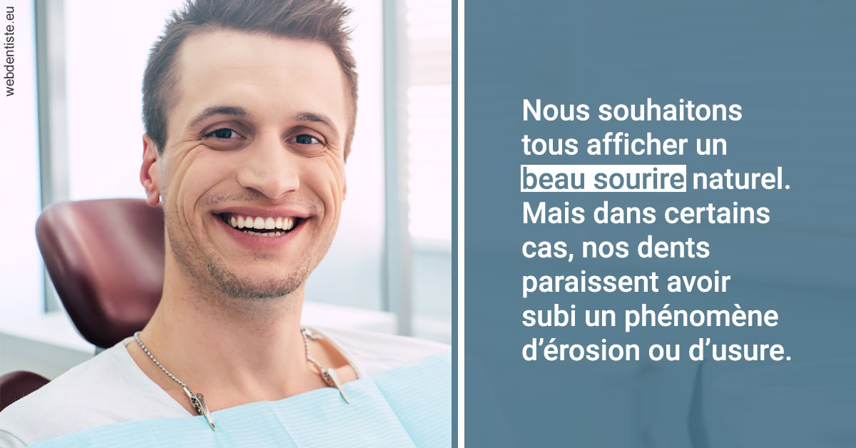 https://dr-knafou-abensur-anita.chirurgiens-dentistes.fr/Érosion et usure dentaire
