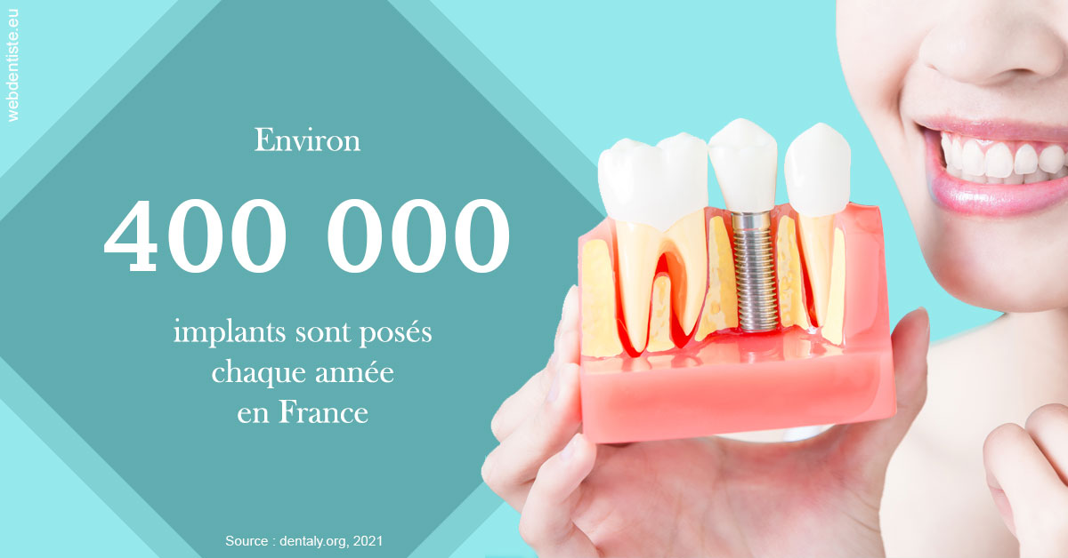 https://dr-knafou-abensur-anita.chirurgiens-dentistes.fr/Pose d'implants en France 2