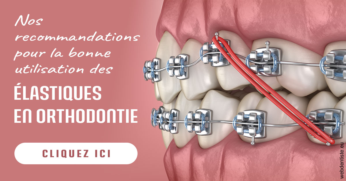 https://dr-knafou-abensur-anita.chirurgiens-dentistes.fr/Elastiques orthodontie 2